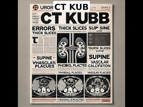 Imaging of Urolithiasis