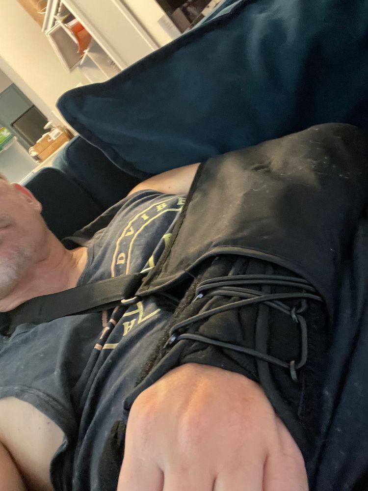 Awkward photo of Mike leaning back on the coach after getting back from urgent care. His wrist is in a brace and arm in a sling.