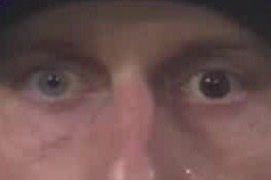 Mad Max close up of face with 2 different coloured eyes