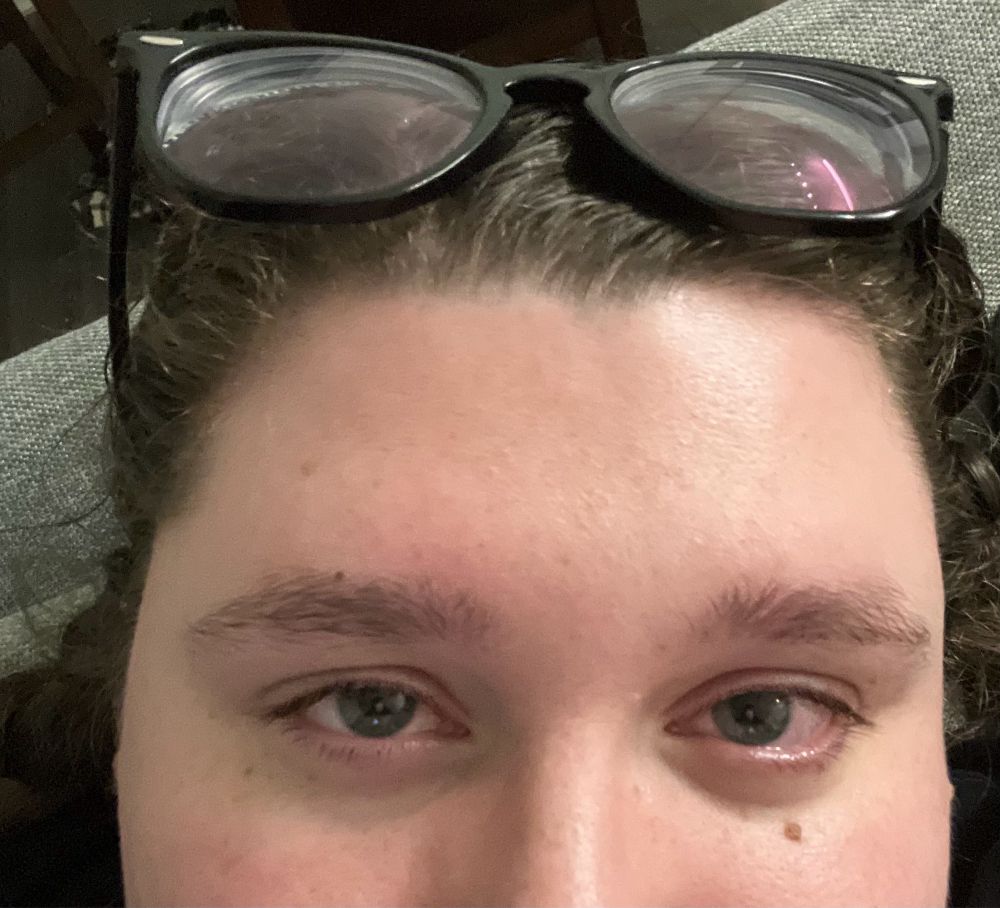 Me with my big glasses pushed to the top of my head, showing that my eyes are read from crying.