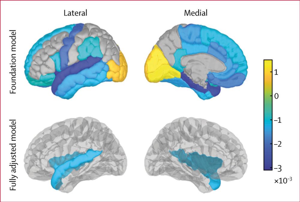 Multiple surgeries could contribute to cognitive decline in older people