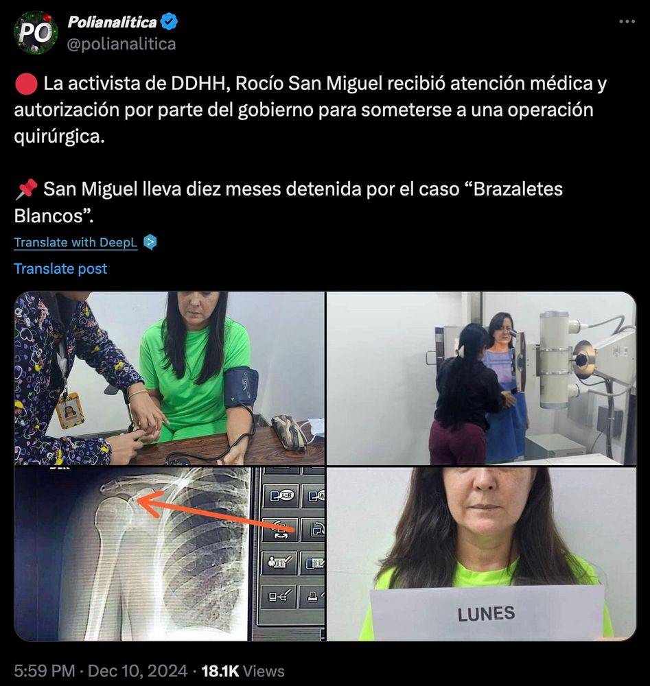 𝙋𝙤𝙡𝙞𝙖𝙣𝙖𝙡𝙞𝙩𝙞𝙘𝙖 @polianalitica on Twitter:

🔴 La activista de DDHH, Rocío San Miguel recibió atención médica y autorización por parte del gobierno para someterse a una operación quirúrgica.

📌 San Miguel lleva diez meses detenida por el caso “Brazaletes Blancos”.