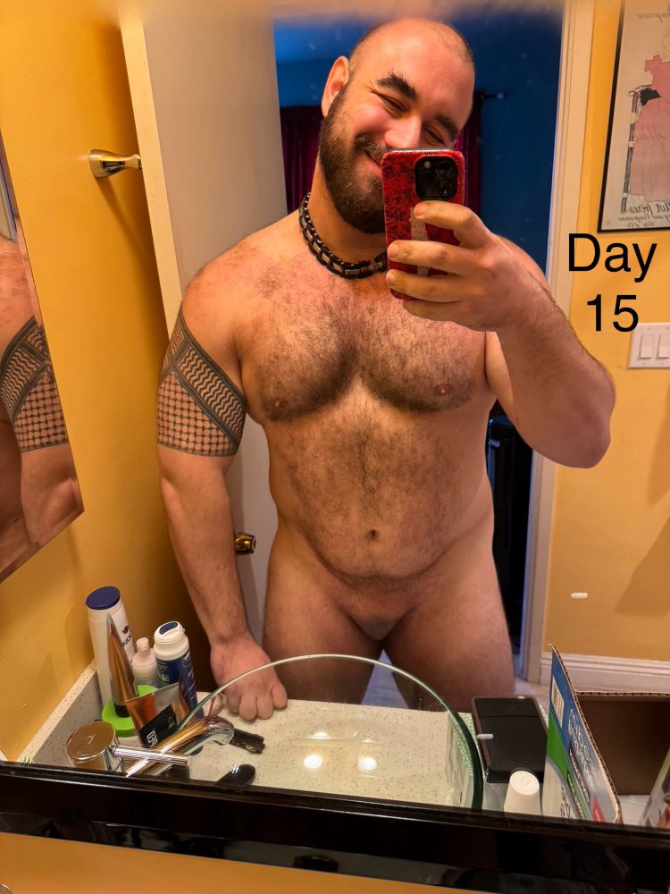 My most recent post surgery selfie 