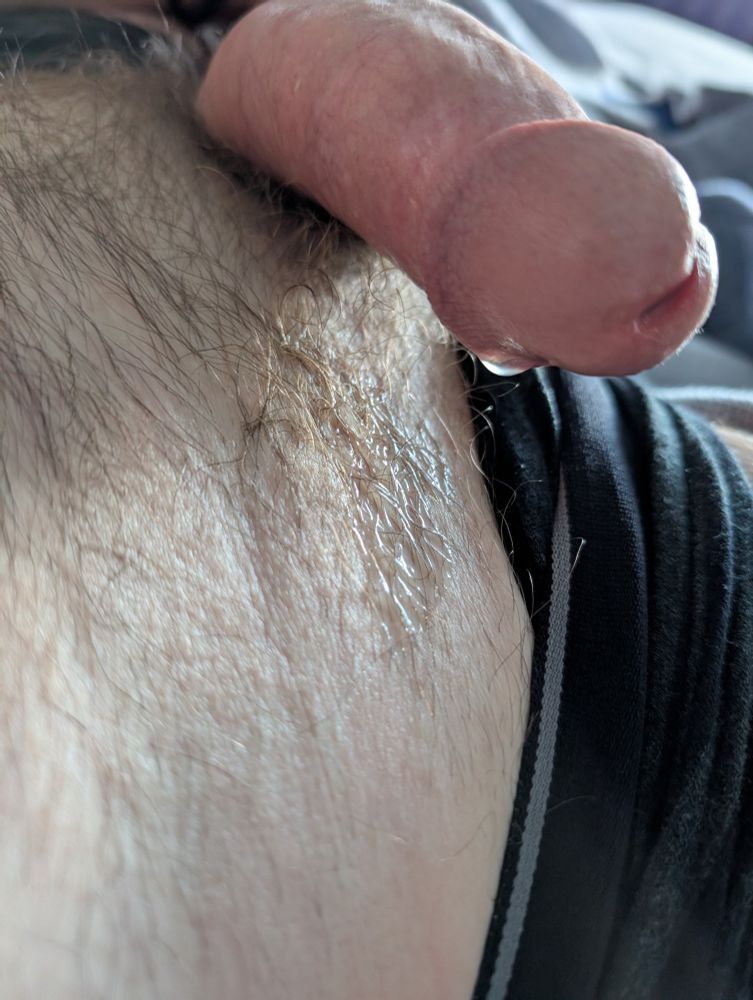 A semi-hard penis with a drop of cum running down the head over a wet spot on the skin above a pulled down waistband.