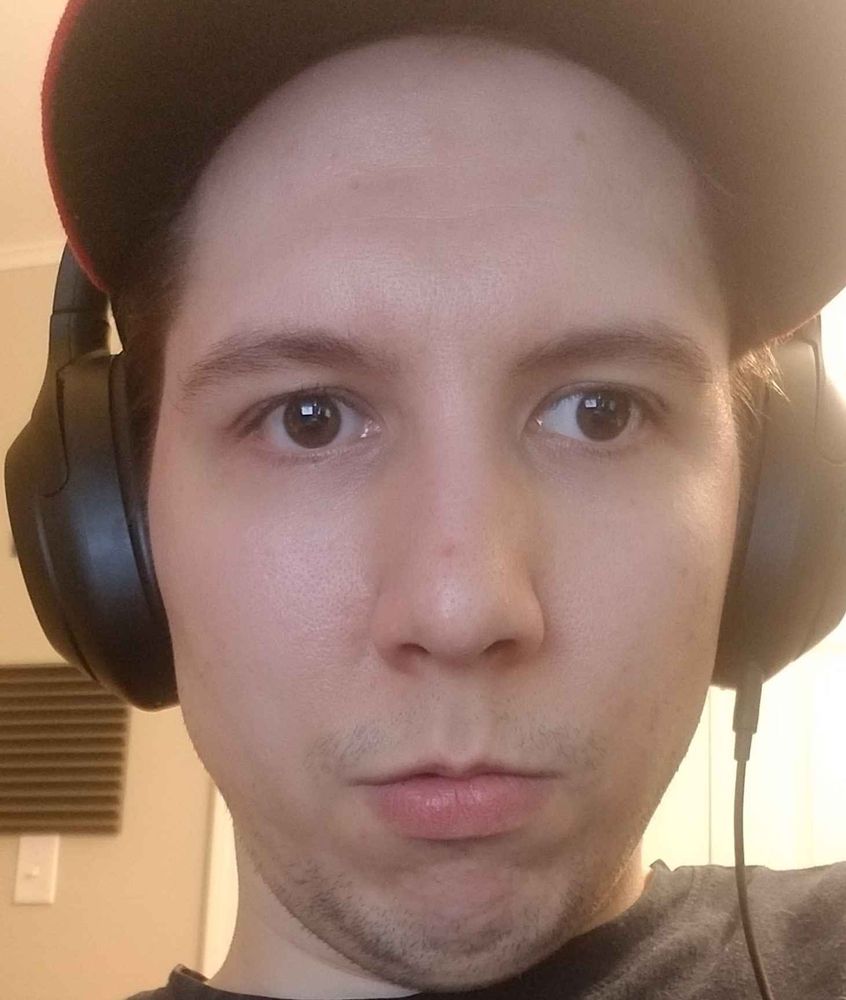 A close up photo of a bewildered looking 30-something year old man who is very, very wall-eyed.