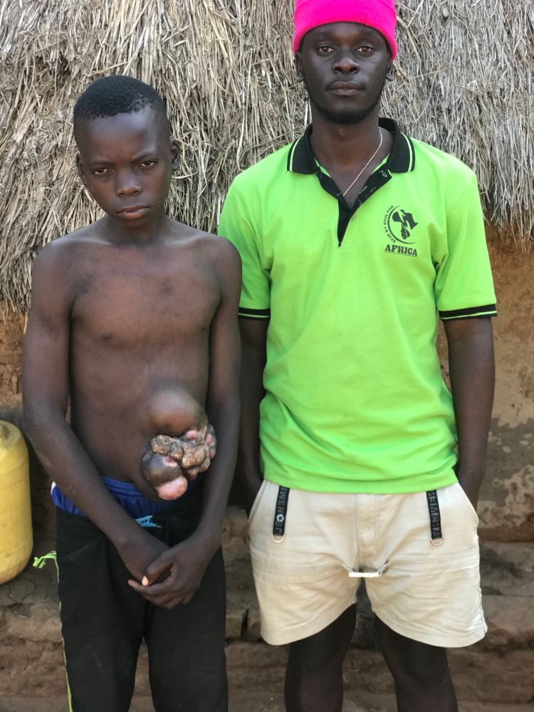 Even 1$ helps , donate today 