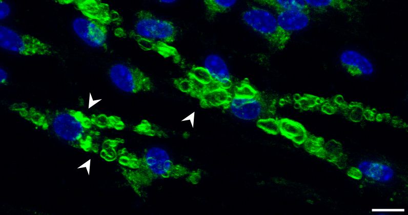 Confocal image of a demyelinating coculture. Fluoromyelin is in green and nuclei in blue. Arrowheads point to myelin ovoids and myelin debris.