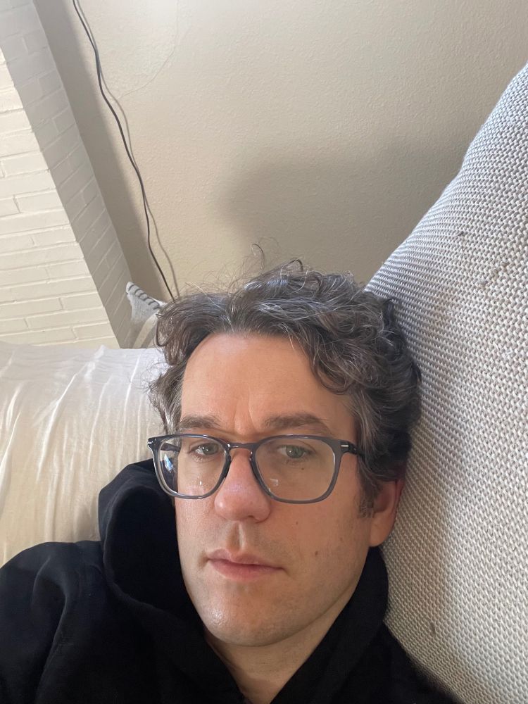 Selfie liking a bit over the jawbone pain post dental implant. 
