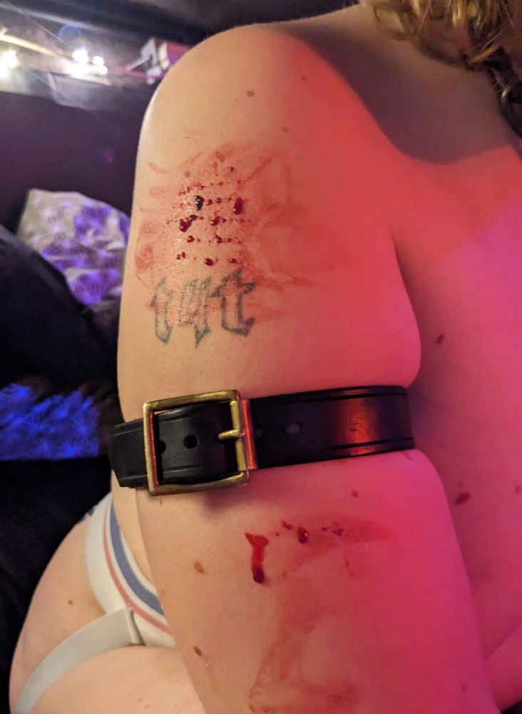 Butch trans woman wearing black leather bicep band and white athletic jockstrap. Close-up of right arm, with a variety of needleplay wounds oozing blood, surrounding a T4T tattoo.