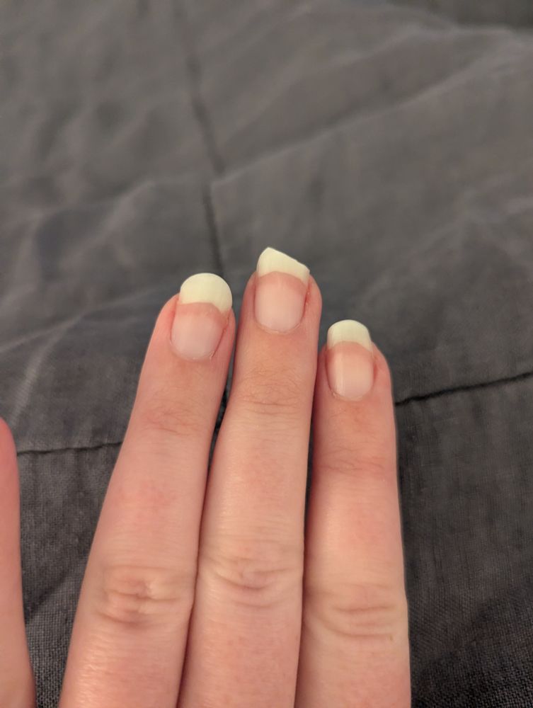 Photo of my fingernails. The nails on the index and ring fingers are nice and long and round, but the nail on the middle finger has a big chunk broken off of it.