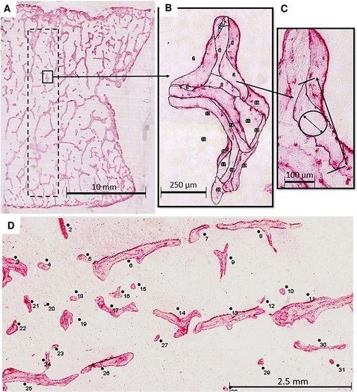 Image from the paper illustrating a cross-section of a human vertebra, a region of interest within that vertebra, as well as the BSU that have been manually traced with the trabeculae so that they can be measured.