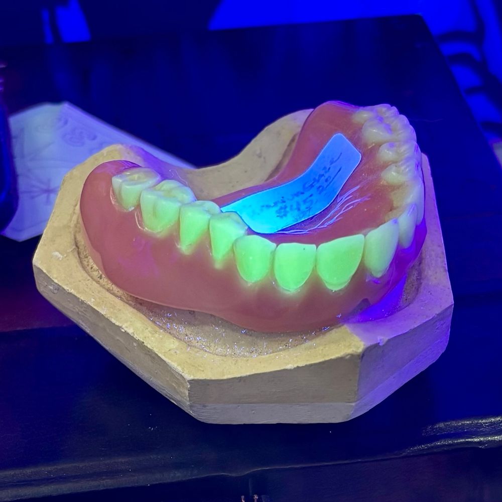 Antique Uranium containing dentures, false teeth, fluorescing green under a UV flashlight.

Brightly uranium doped false teeth were not uncommon many decades ago.

First time the photographer has seen these in person and regrettably the seller is asking $45USD. 