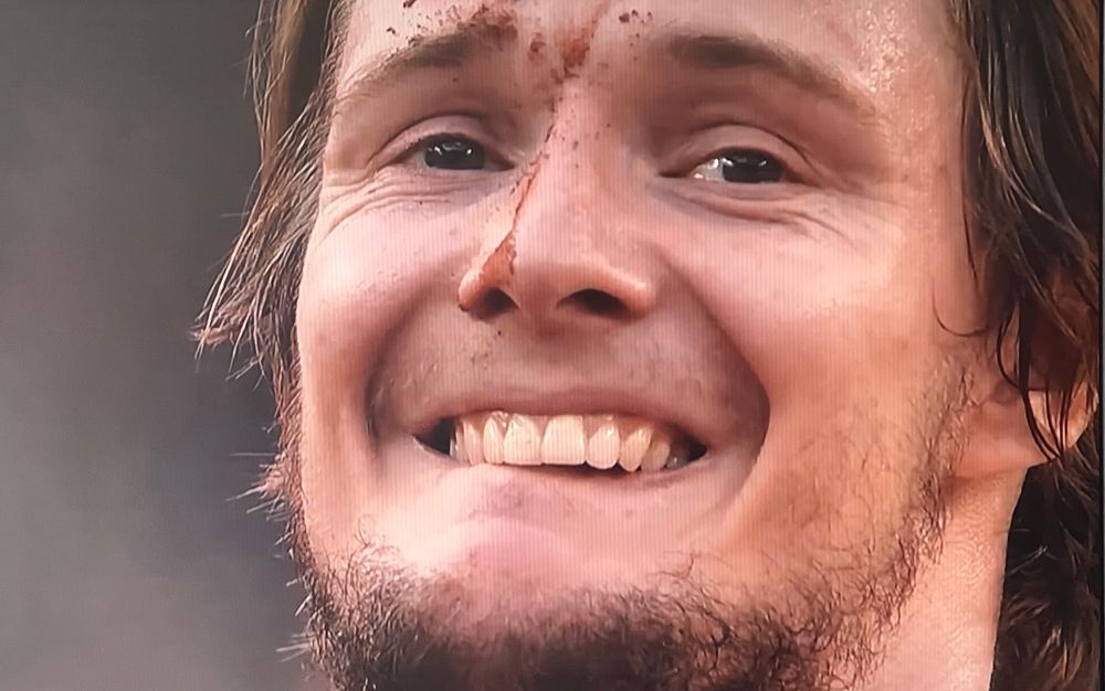 A close-up of Kazakhstan tennis player Alexander Bublik with a mixture of sweat and clay running down his forehead and nose after winning his match against the UK’s Jack Draper at Roland Garros. 