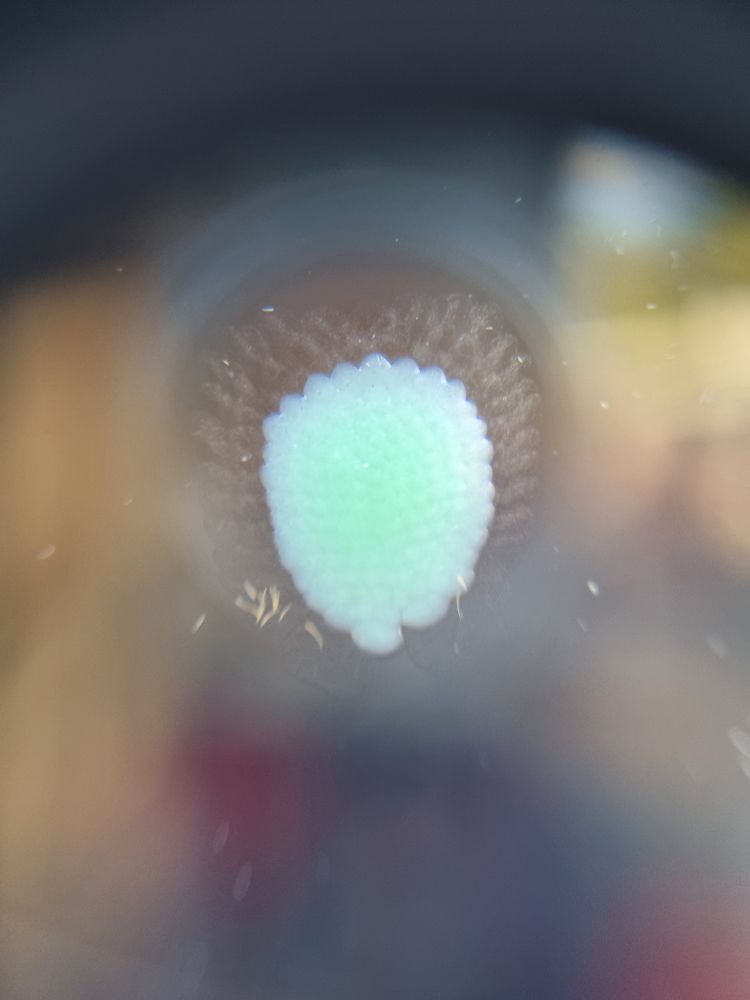 Carnation Tortrix Cacoecimorpha pronubana eggs
