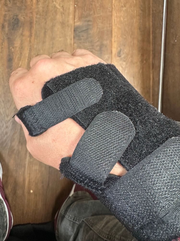 A bollocksed wrist. Make your own jokes.
