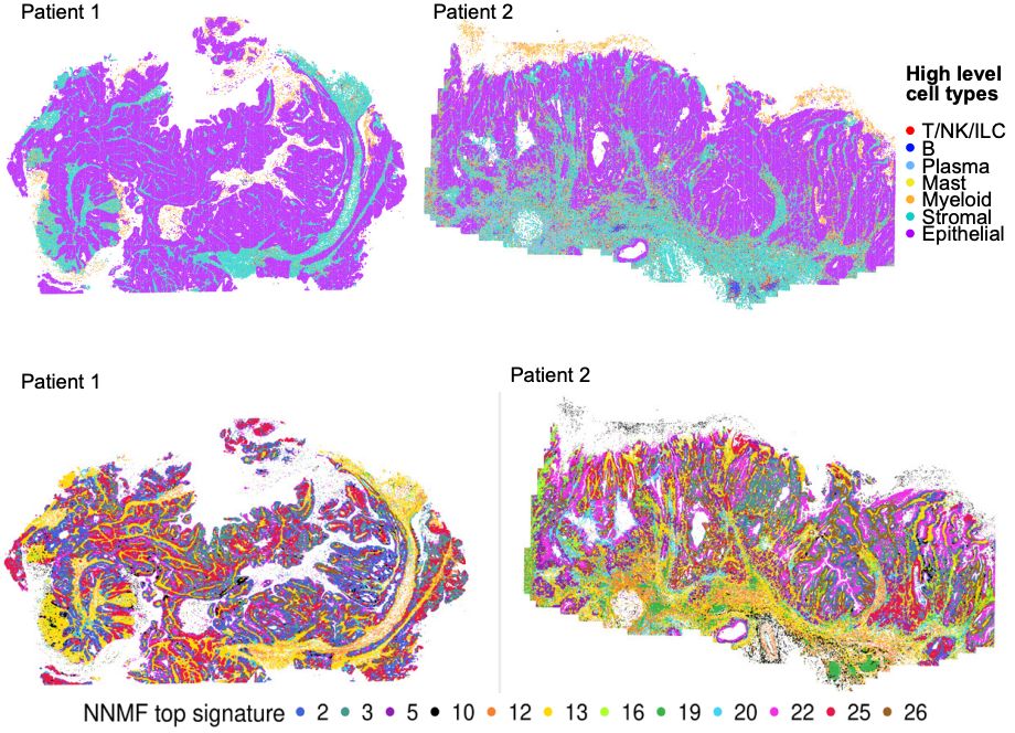 Top row: cell types in two patient samples; Bottom row: NNMF signatures in the same two samples, showing substantial complexity.