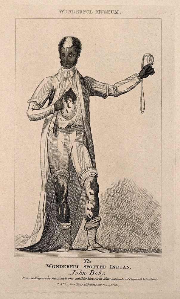 John Boby, a black man with white markings.
Reproduction of an etching, 1803.