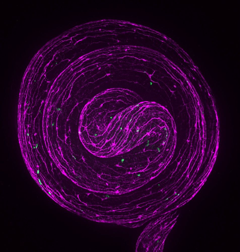 Coiled gut with neurons tiled throughout 