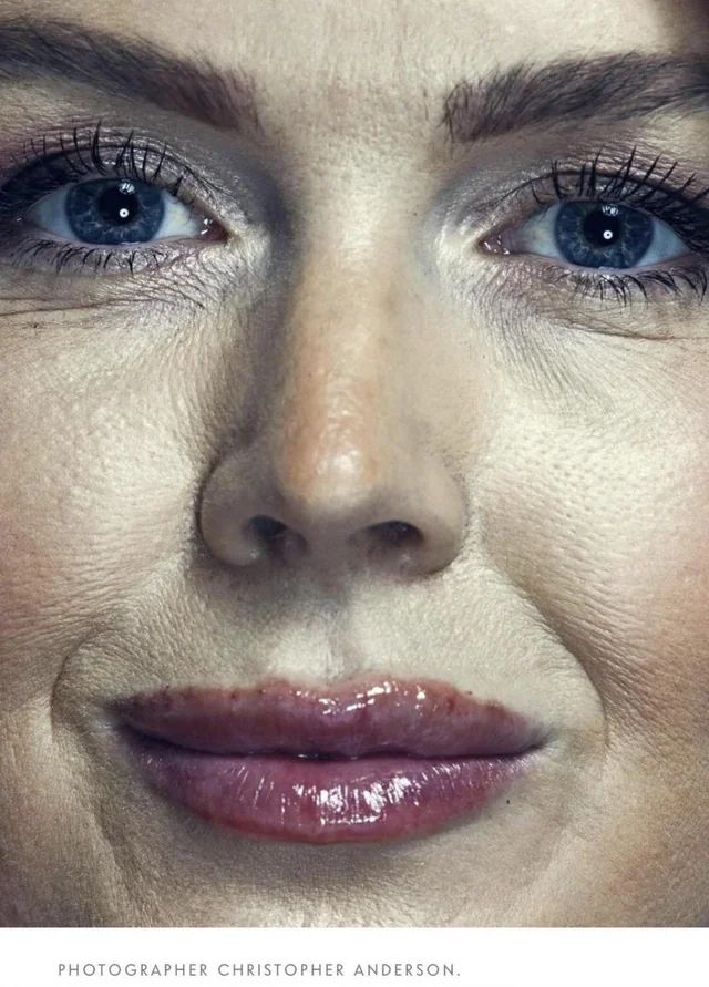 scary close up of karoline leavitt in vanity fair where her lip filler track marks are obvious and accentuated

her skin looks dry and caked with makeup but not enough to hide her scaly texture and weird pearlescent skin tone or the blotches on her nose

under text says PHOTOGRAPHER CHRISTOPHER ANDERSON.