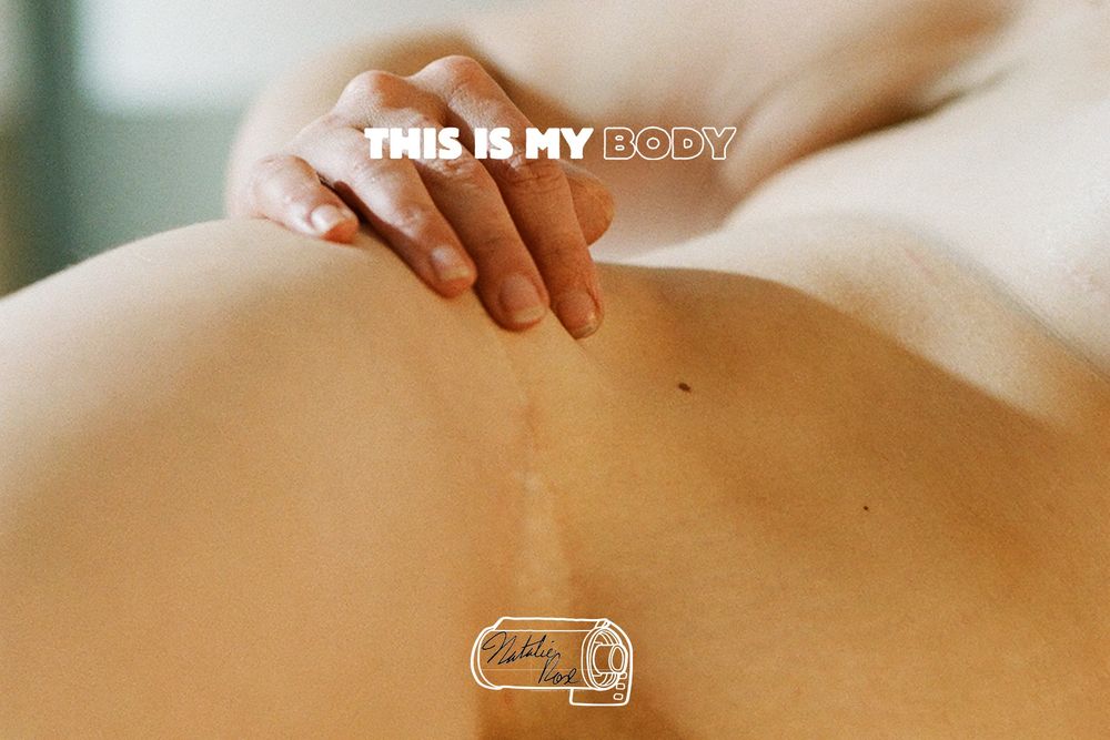 Natalie (she/her) is nude in this softly lit, close-cropped image focused on the lower portion of her torso. Her left hand rests on the top of her bare hip, fingers gently curved, positioned just above the pelvic region. The natural texture of her skin is visible throughout the frame, including soft stretch marks across her hip, a faint horizontal pelvic scar near the base, and several small blemishes and variations in tone. The lighting is even and warm, revealing every fold, shift, and detail in the skin. Her hand introduces both movement and stillness — a gentle act of self-touch, placed with ease and intention. The composition excludes her face and any background, directing full attention to form, light, and the body’s physical presence. Nothing is retouched; the image embraces honesty over perfection. Fine hairs and pores catch light subtly across her lower abdomen and waist. 