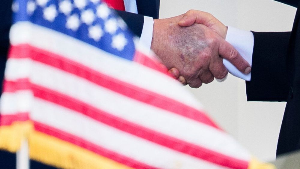 Bruising on hand of Donald Trump