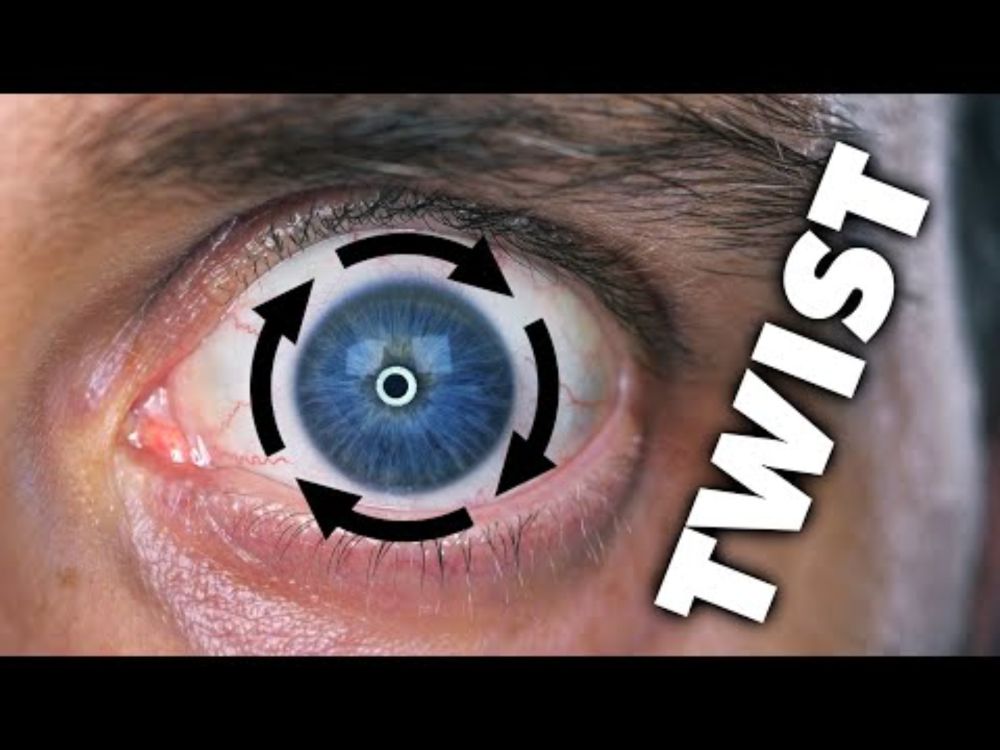 I Can Twist My Eye Around Its Pupil (And So Can You)