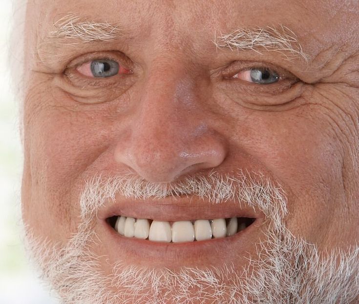A closeup of Hide The Pain Harold