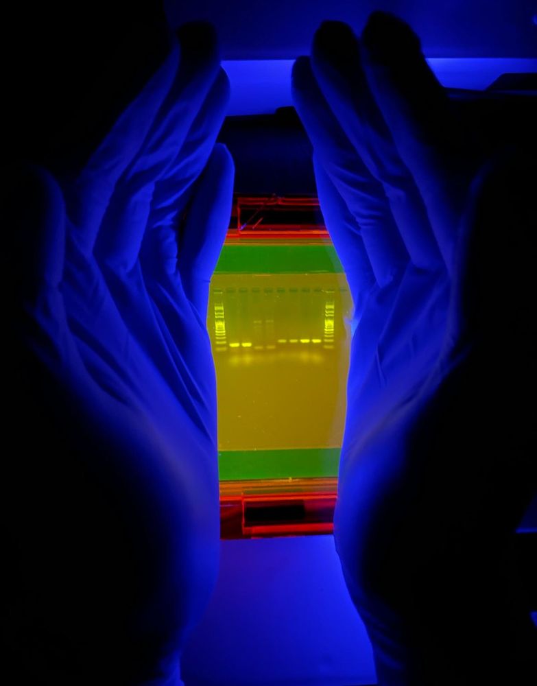 Two hands encircling an agarose gel, illuminated by blue light