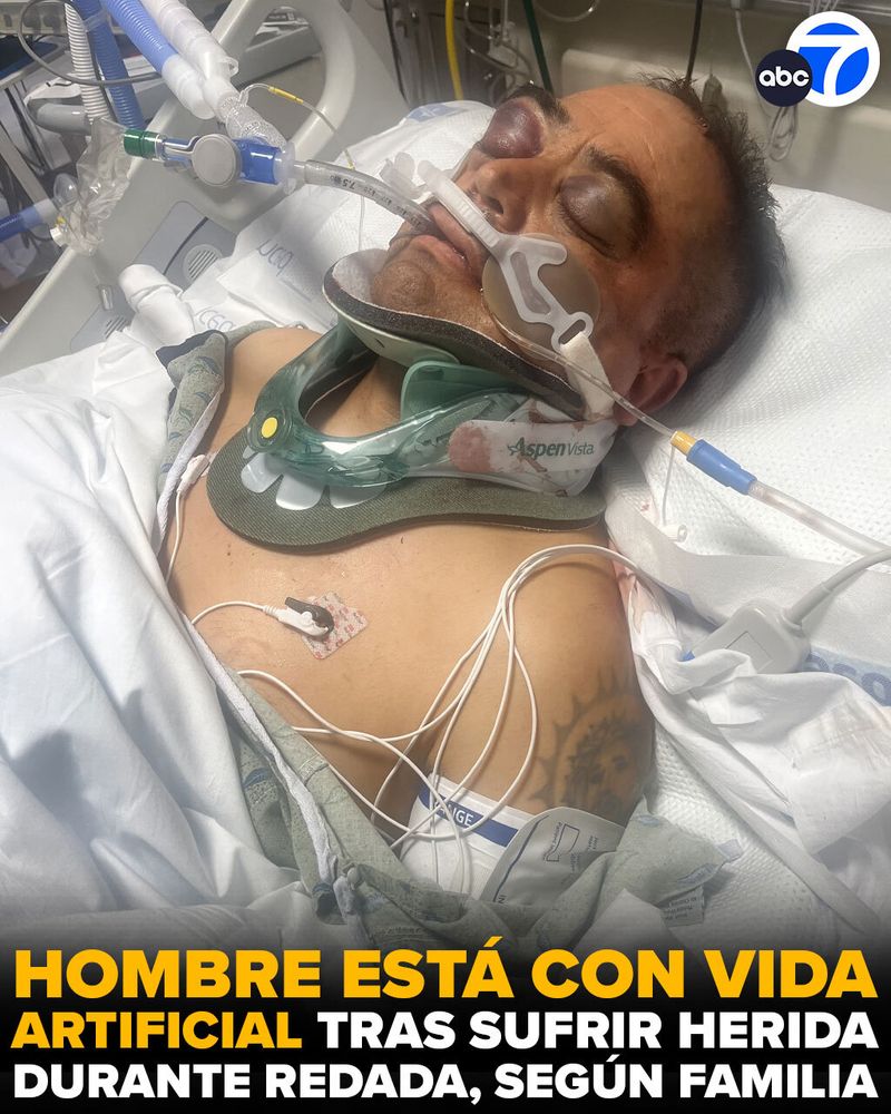 Un hombre se encuentra luchando por su vida tras resultar herido durante una redada de inmigración en una zona agrícola de Camarillo el jueves. Según su familia, Jaime García, cayó 30 pies desde un edificio mientras posiblemente intentaba huir de los agentes federales