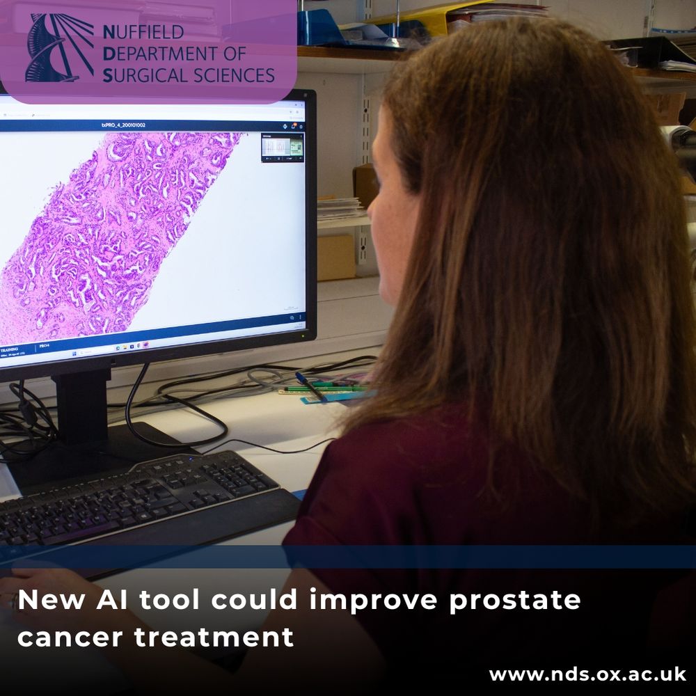 NDS logo, Picture of Clare Verrill using software, text that reads: New AI tool could improve prostate cancer treatment, www.nds.ox.ac.uk