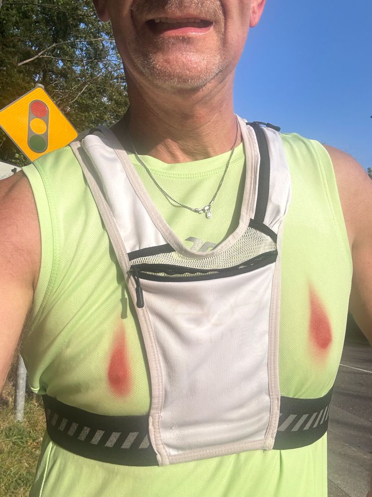 Bleeding nipples post running!