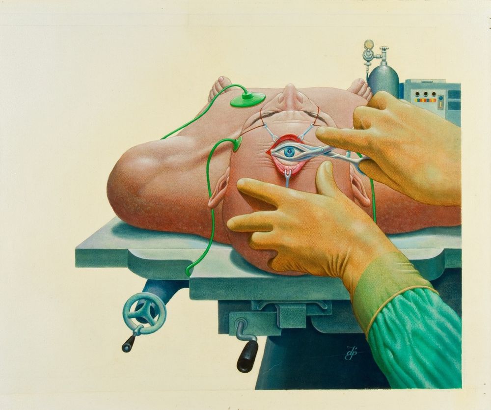 A nude guy lies on a cold operating table. He has a third eye high on his forehard, which is being pried open by the gloved hands of an offscreen doctor with a pair of plyers.