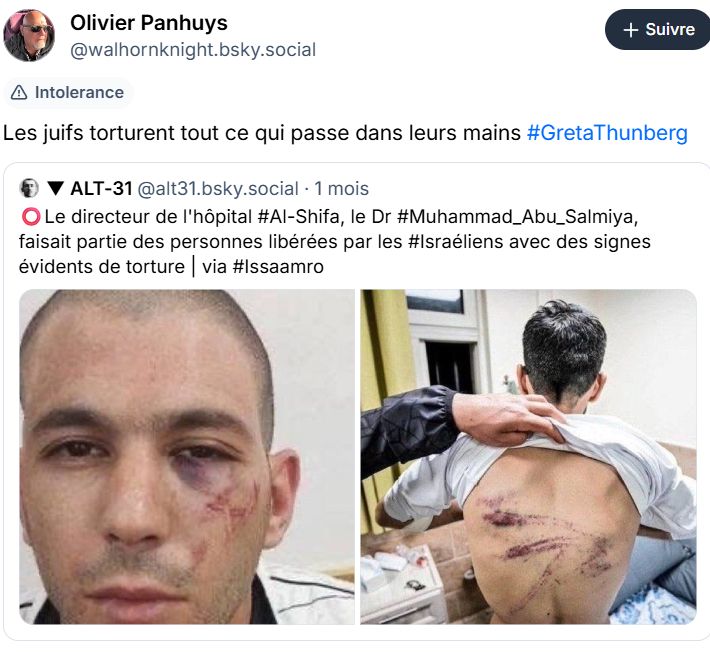 Post disant "Les juifs torturent tout ce qui passe dans leurs mains"