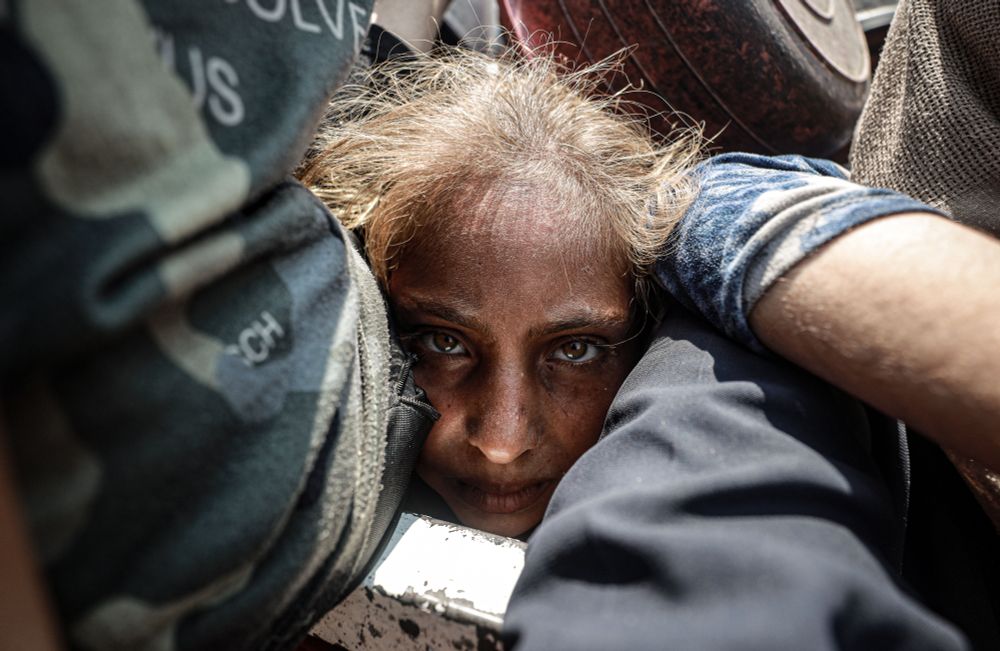 A close view of a child's face, smashed among other people in a crowd. (Khames Alrefi / Anadolu / Getty)