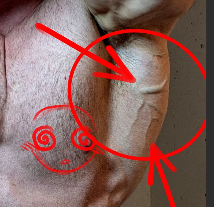 a crop of the above image, focused on prominent veins. they are circled and pointed to by red arrows