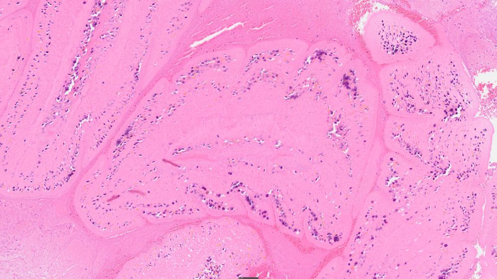 Here are cross sections of the degenerate tapeworm larvae from the previous image.  They lack detail but the calcareous corpuscles are still visible.  These appear to be strobilocerci.  As I understand it, this tapeworm initially forms cysticerci in the rat which then metamorphose into strobilocerci.  H&E-stained section.  