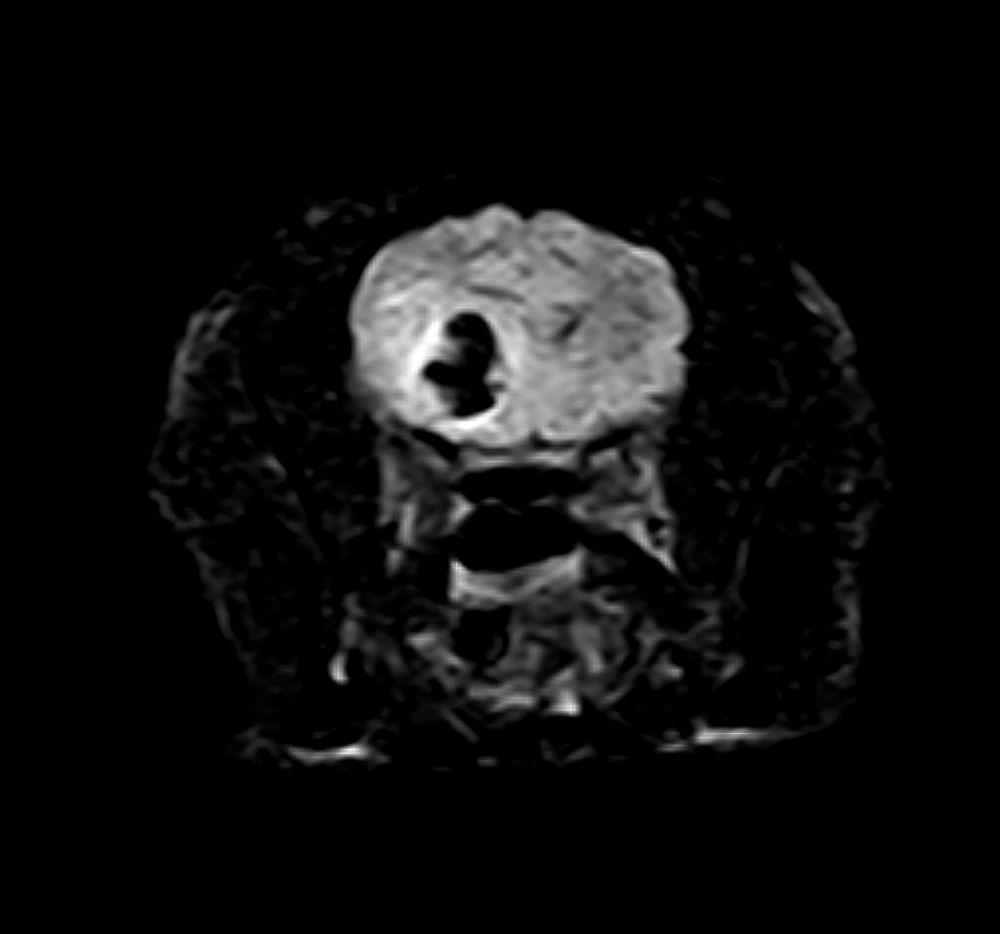 MRI of a cat brain.  There is a cystic mass in the right temporal lobe that extended to the frontal lobe.