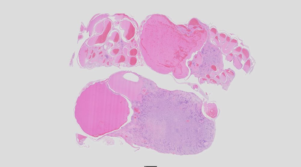 Two sections ostensibly of ovary are present on this microscope slide. The subgross reveals the slightly basophilic masses with tortuous blood vessels adjacent to them.