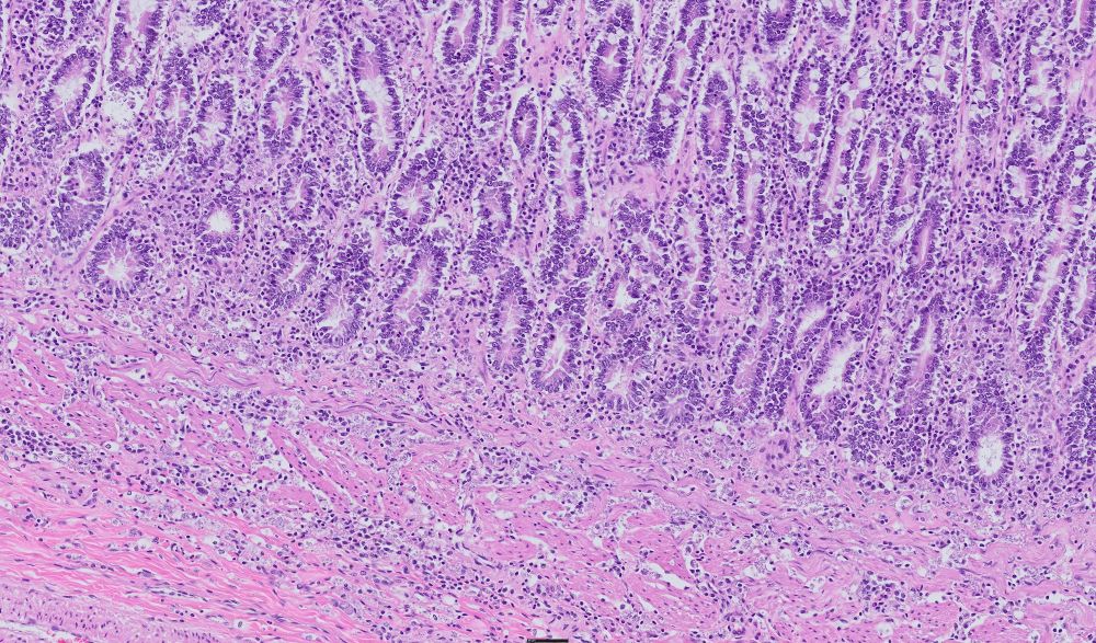 Small intestine from a dog with chronic inflammation.