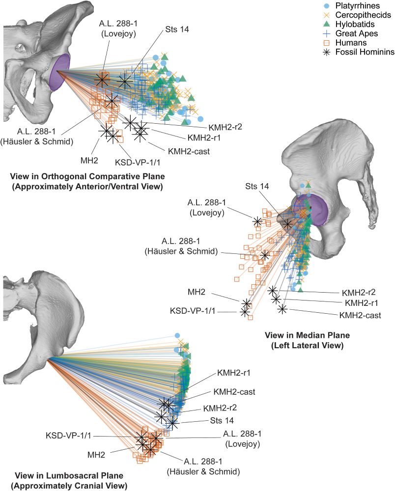 3D acetabular orientation vectors (normal vectors to the acetabular plane) overlayed on a human pelvis and shown in views representing the median plane, lumbosacral plane, and orthogonal comparative plane. Colors of the vectors and colors and symbols for the data points represent their taxonomic group. Within each view, all vectors are the same length. The view in the orthogonal comparative plane (top left), which approximates an anterior/ventral view, and the view in the median plane (center right) show that humans and most fossil hominins have more ventrally oriented acetabula than other groups but that groups do not differ in their acetabular orientation relative to the lumbosacral plane. The view in the lumbosacral plane (bottom left) approximates a cranial view and shows that humans have more ventrally oriented acetabula than other extant anthropoids, which have predominantly laterally facing acetabula.