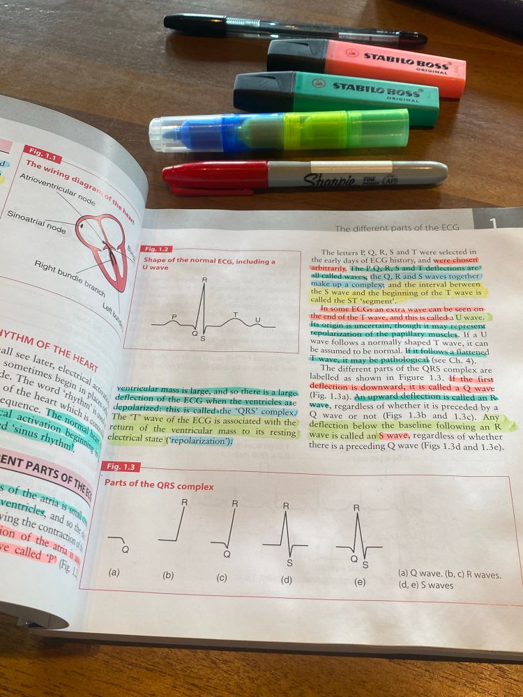 Different parts of ECG.