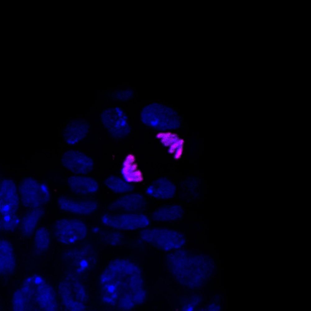 A microscopy picture of a #Drosophila follicle cell in anaphase. 