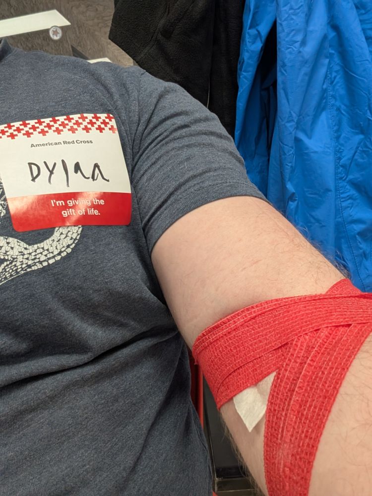 Selfie close up on Dylan's arm, bandaged with a red bandage around his elbow following a blood donation 