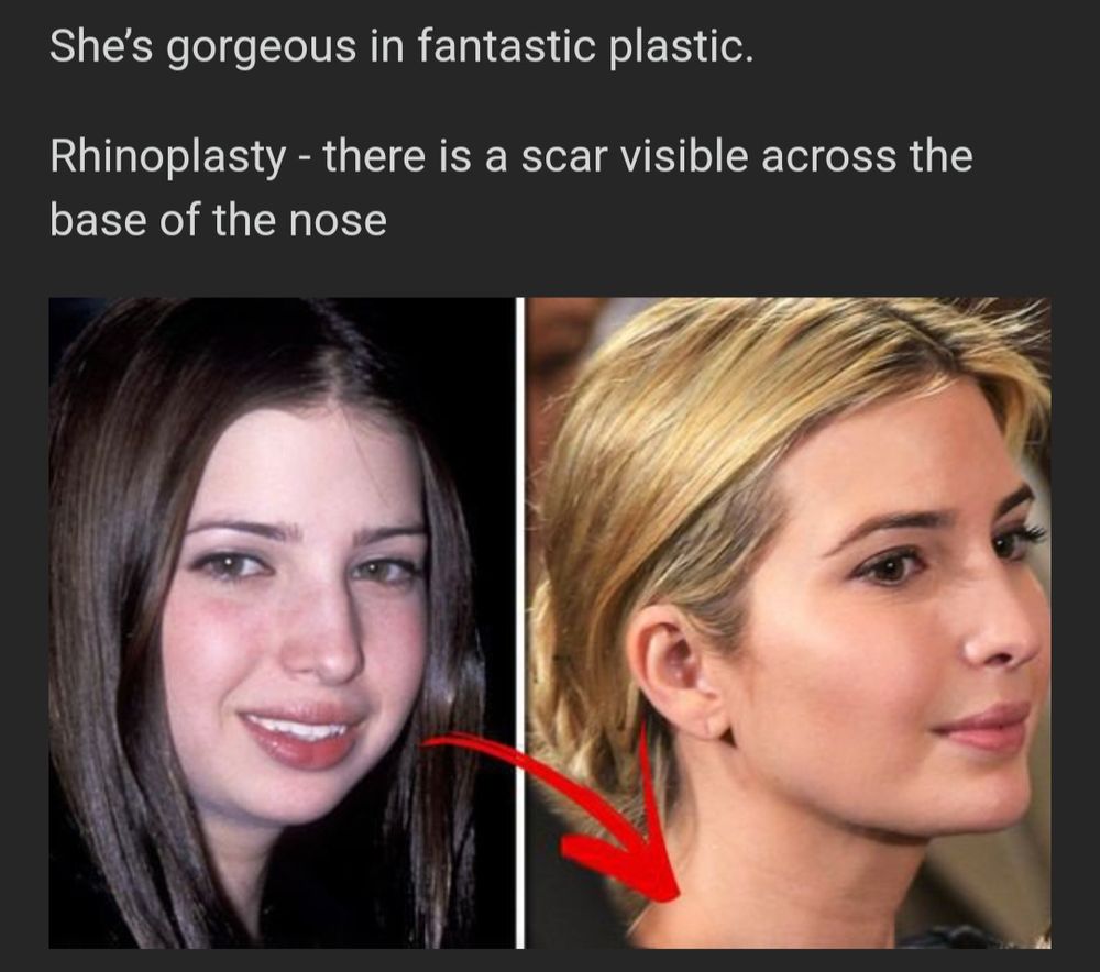 Comment image