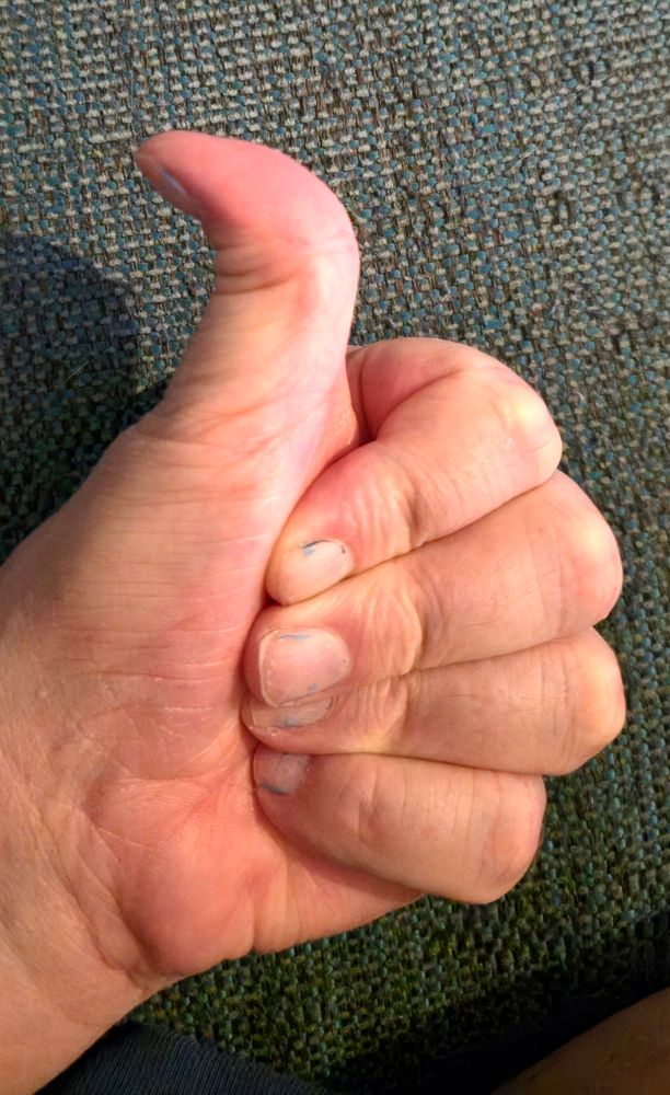 Peukalo pystyssä oleva käsi, taustalla vihertävä kangaspintainen sohva.