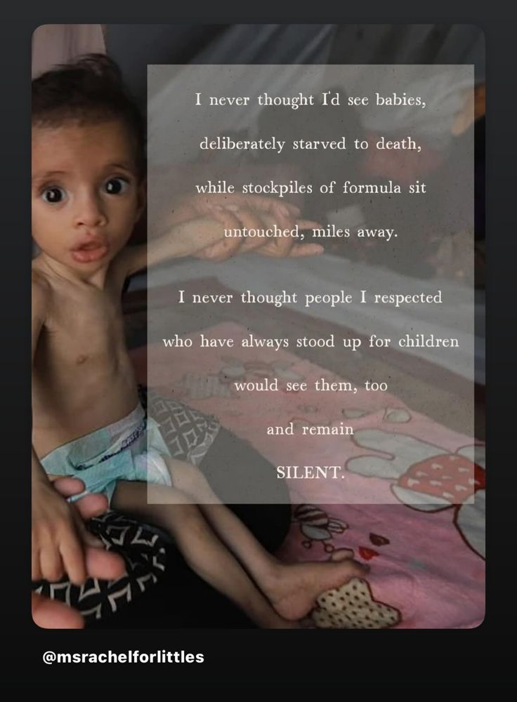 An Instagram post from Miss Rachel
A photo of a baby in Gaza who the US and Israel are starving to death. This baby is desperately thin and their beautiful big eyes are looking directly at the camera.  Text on top reads:
I never thought I'd see babies, deliberately starved to death, while stockpiles of formula sit untouched, miles away.

I never thought people I respected who have always stood up for children would see them, too and remain SILENT.

@msrachelforlittles