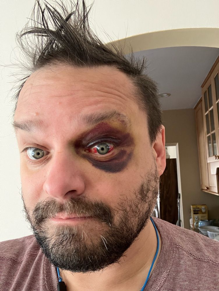 Me looking like a degenerate