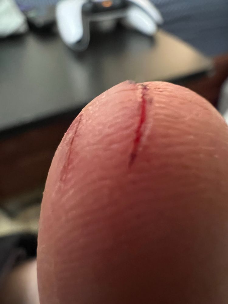 Can hear Barry Zuckercorn in my head due to how testicular (sans hair obvs) this appears 