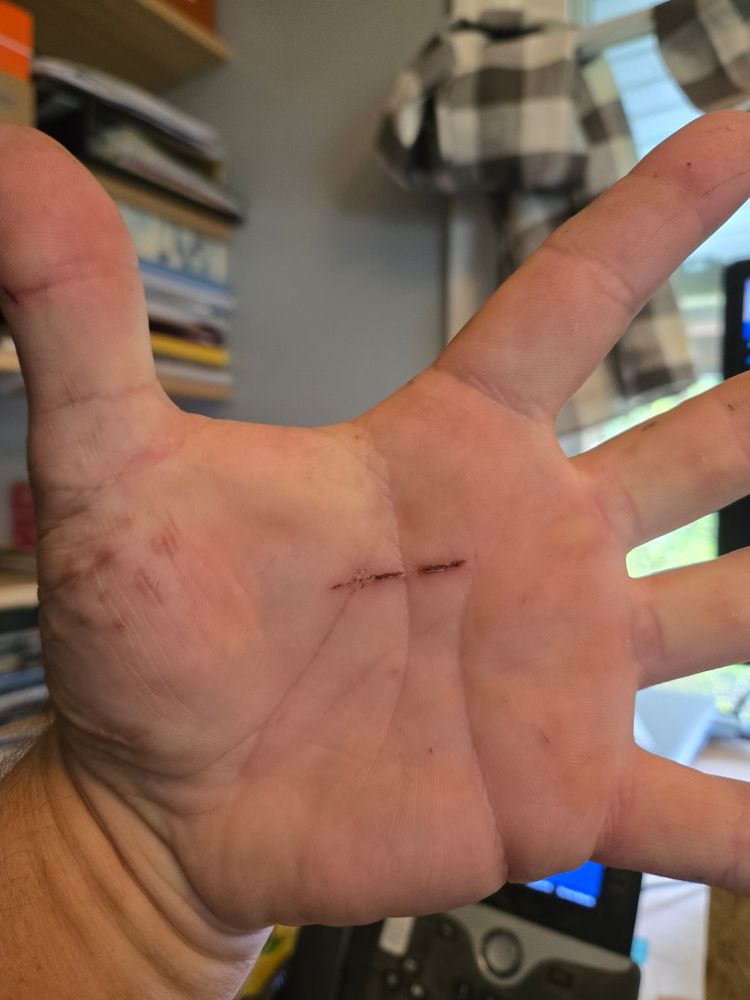 The palm of my left hand. There is a cut that crosses two of the lines in the palm, creating what resembles "A-"