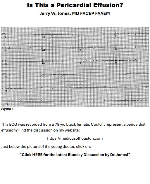 A 12-lead ECG with low voltage. Could this ECG represent a pericardial effusion?